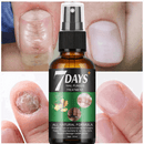 Belleza 7 Days Nails Ecuador – Trata los Hongos y Recupera tus Uñas en una Semana de Tendeli Ecuador en
