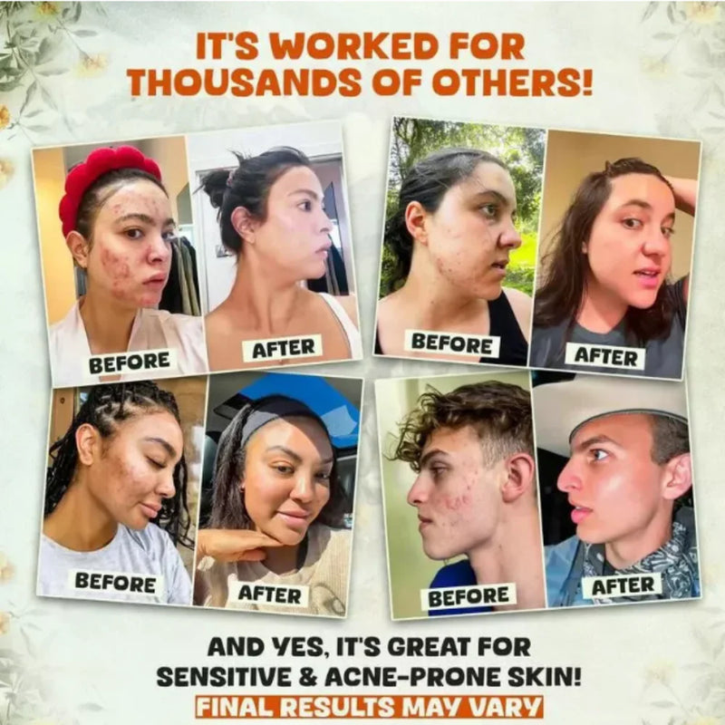 Sebo de Res Evil Goods – Bálsamo Natural para Piel Radiante 🌿✨