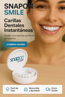 Mujer sonriendo con carillas dentales en Ecuador SnapOn Smile removibles en estuche blanco