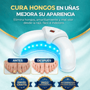 Salud Dispositivo Laser para Hongos en las Uña de Tendeli Ecuador en